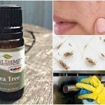10 Ways Having A Bottle Of Tea Tree Oil Will Change Your Life