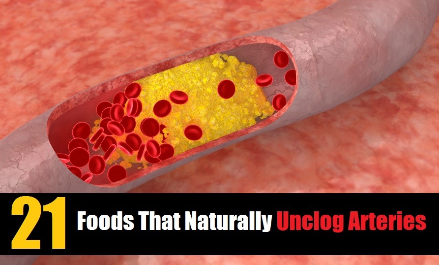 21 Foods That Naturally Unclog Arteries