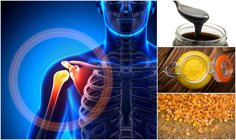14 Most Effective Natural Remedies To Relieve Joint Pain