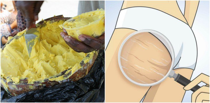 13 Reasons You Should Start Putting Shea Butter On Your Skin & Hair