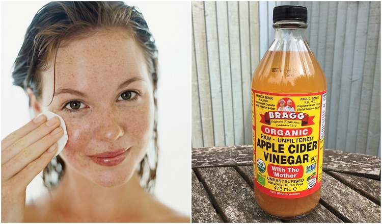 5 Reasons To Wash Your Face (& Skin) With Apple Cider Vinegar