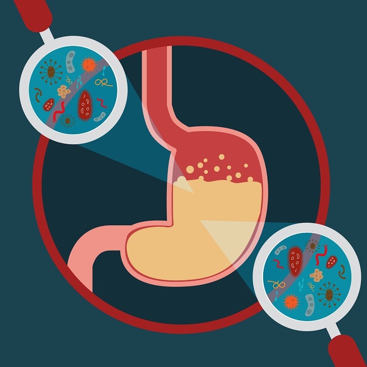 Natural Gut Health Remedies Natural Gut Health Remedies