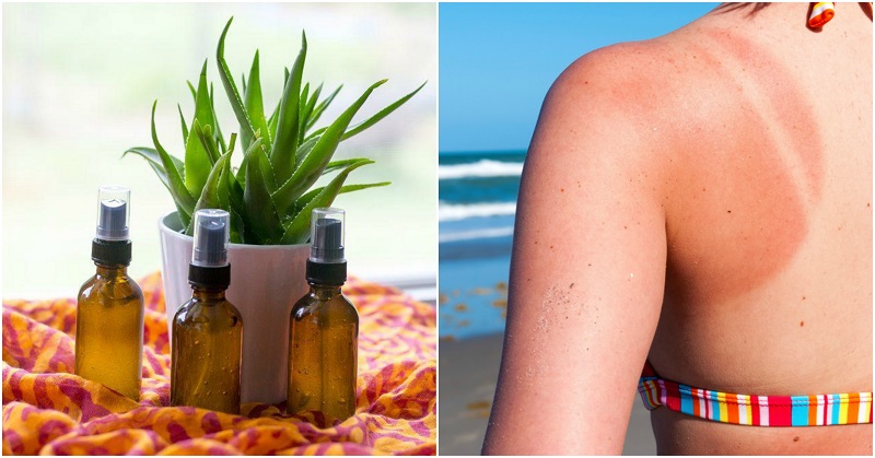 How To Make An After Sun Spray To Instantly Cool & Rehydrate Your Skin