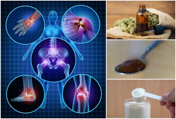 14 Potent Natural Remedies For Arthritis Backed Up By Science 